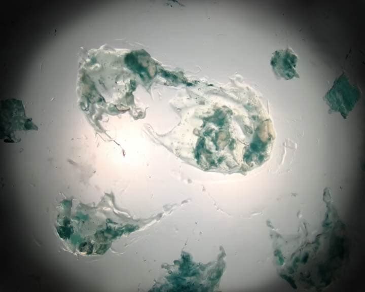 PROTOZOA